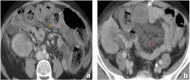 Fig. 10
