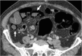 Fig. 11