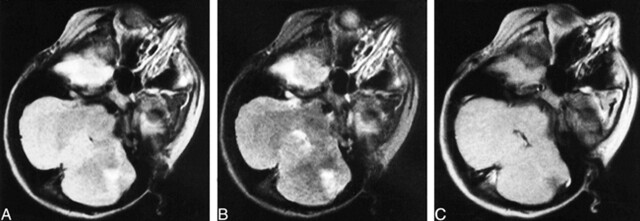 fig 3.