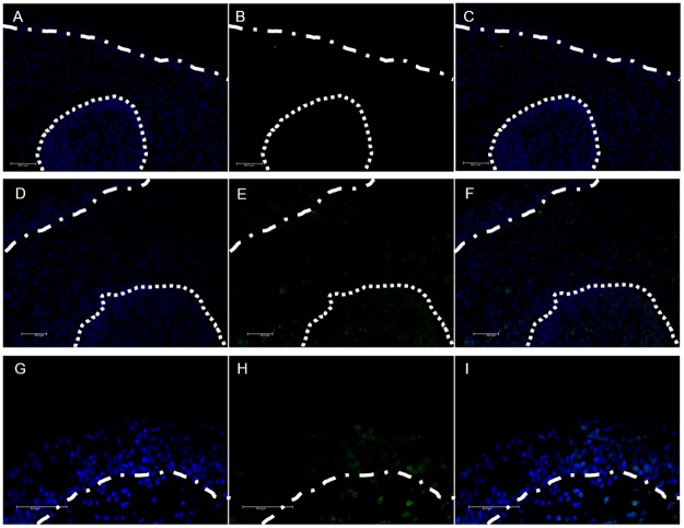 Fig 11