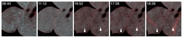 FIG. 5