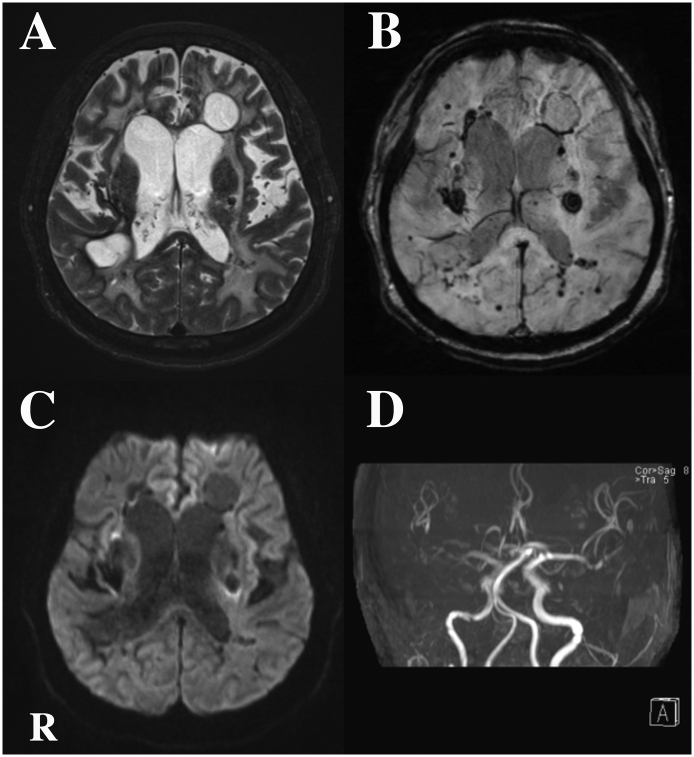 Fig. 2