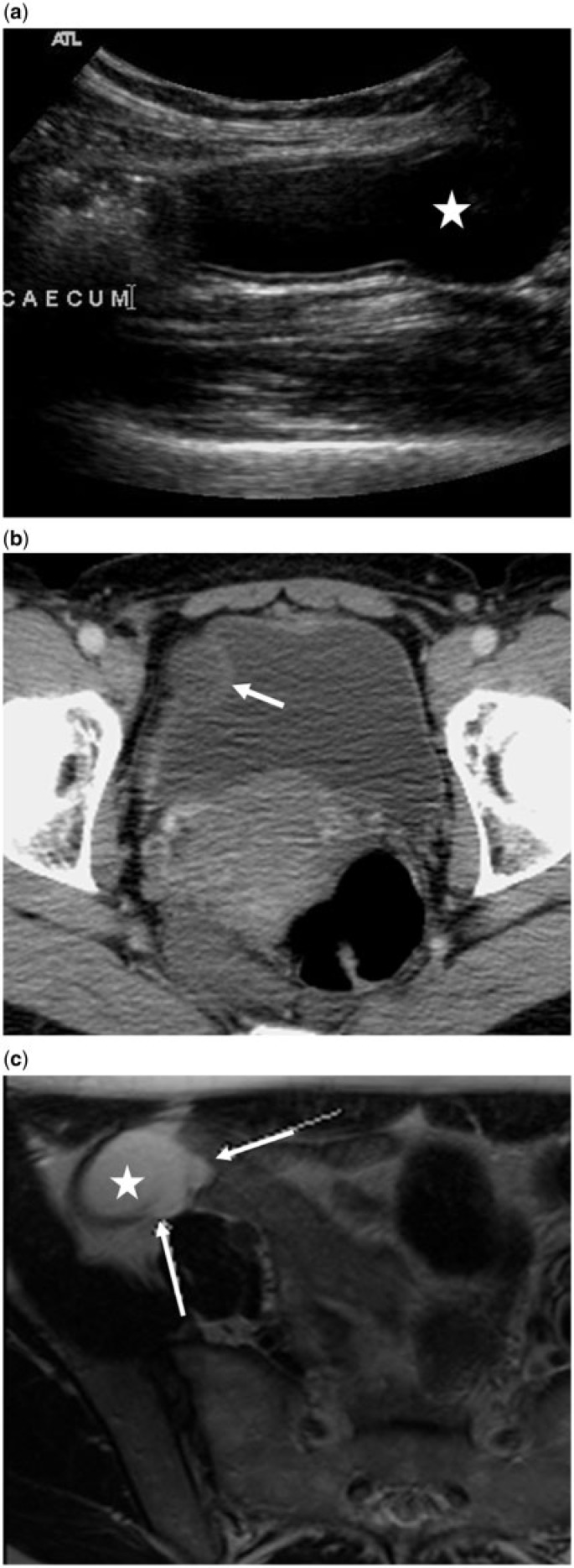 Figure 7