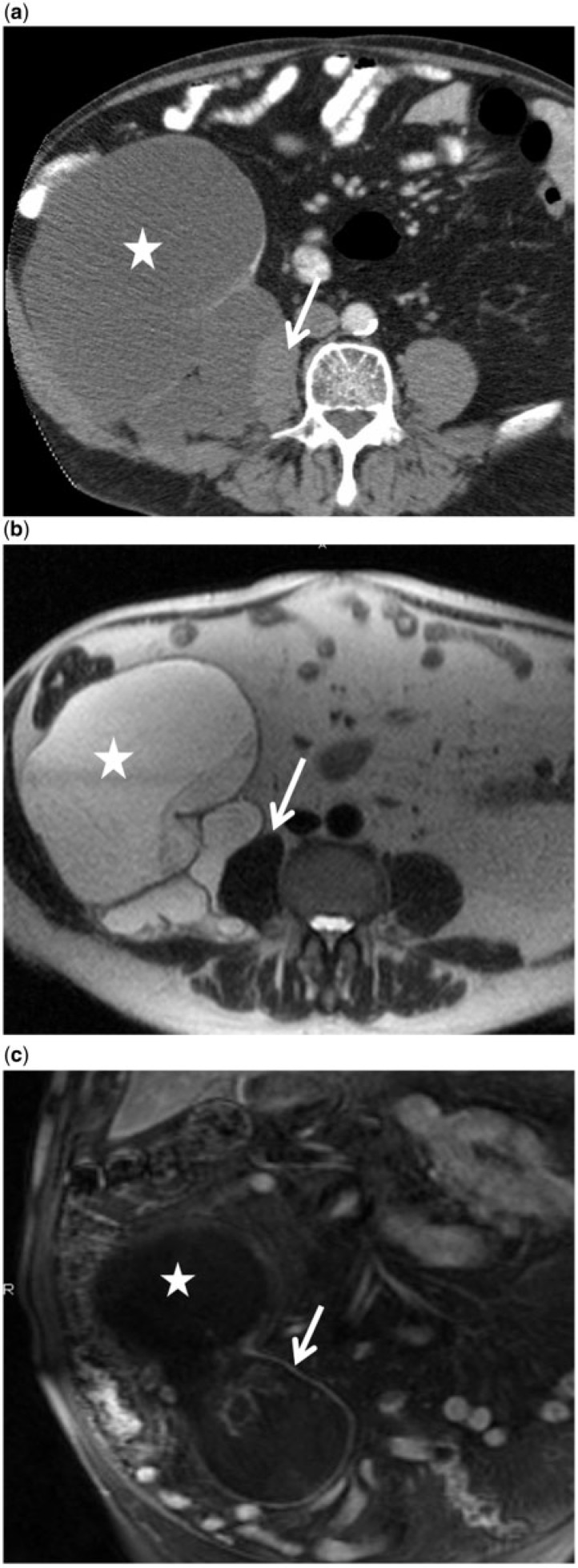 Figure 10