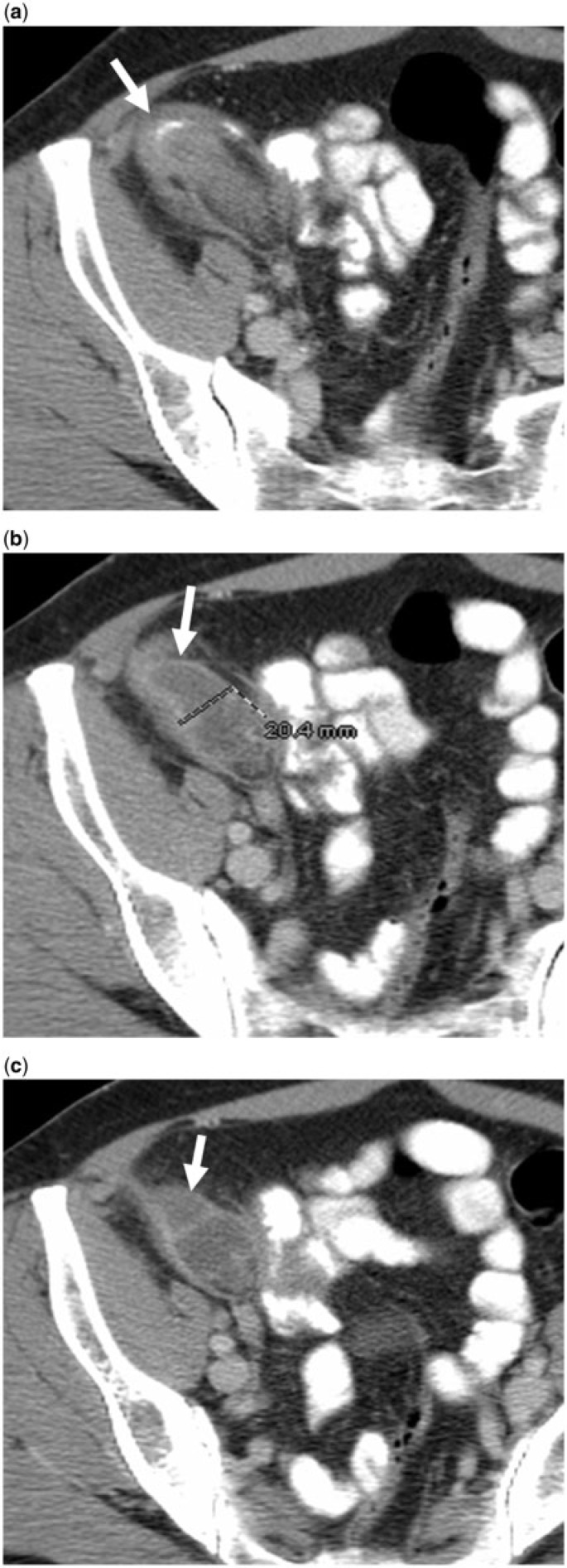 Figure 13