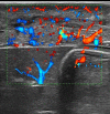Fig. 11