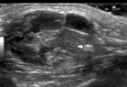 Fig. 13