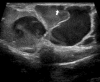 Fig. 16