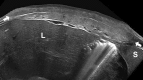 Fig. 10