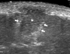 Fig. 18