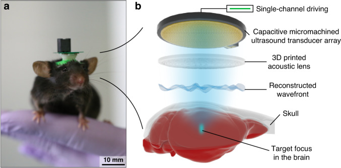 Multifocal skull-compensated transcranial focused ultrasound system for ...