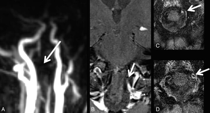 Fig 3.