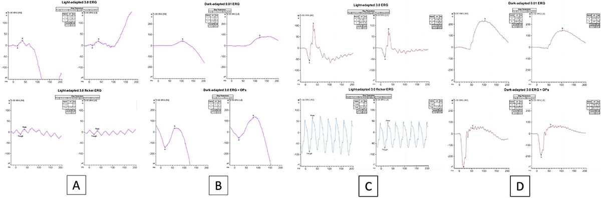 Figure 4A-D.