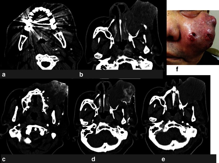 Fig. 1