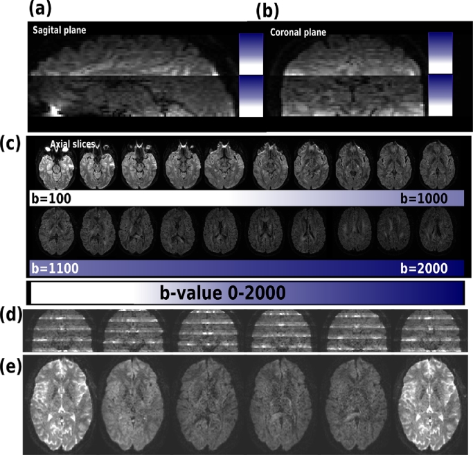 Fig. 11