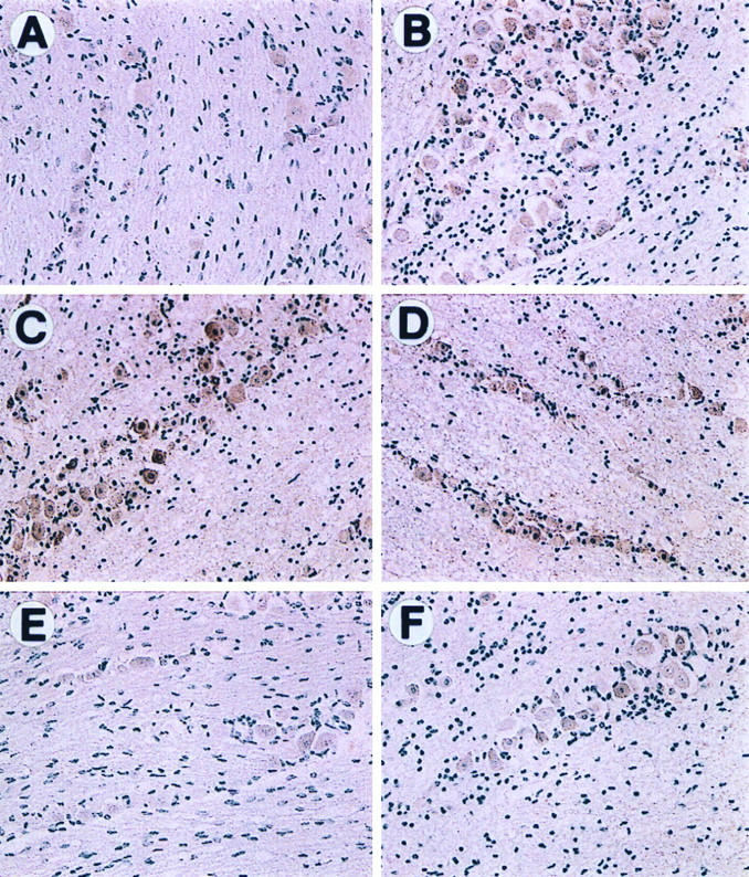 FIG. 6