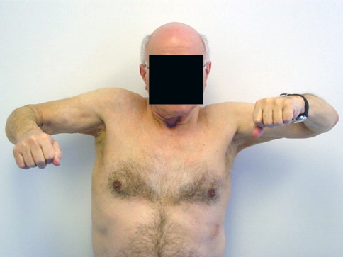 Fig. 1
