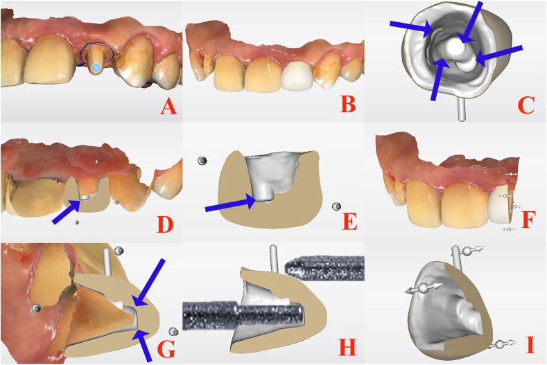 Figure 1