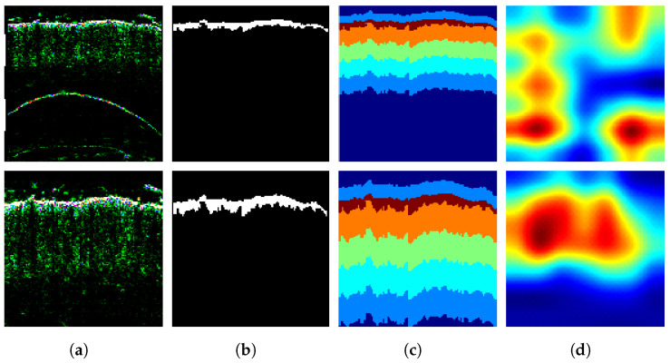 Figure 14