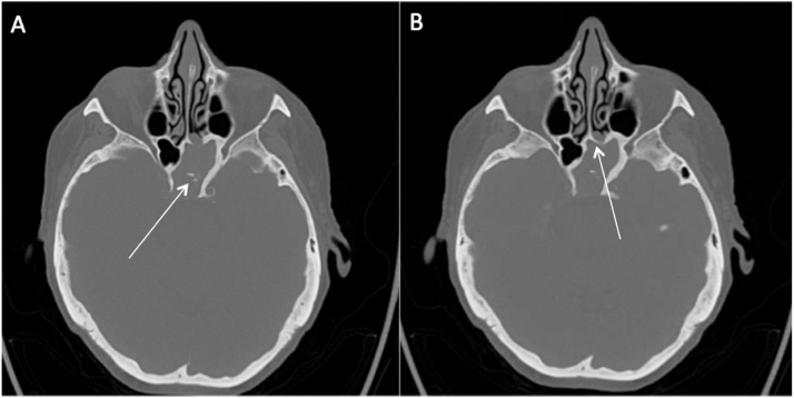 Fig. 3