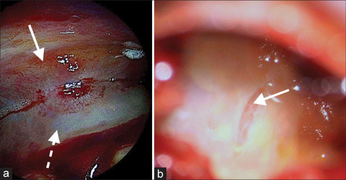 Figure 2: