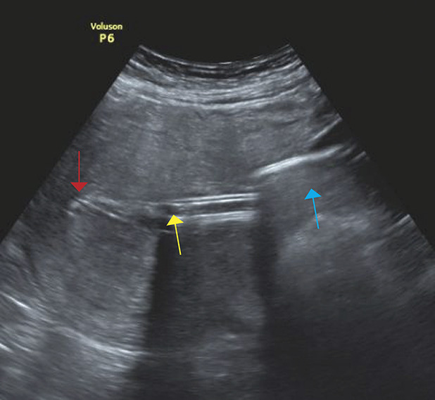 Fig. 2.