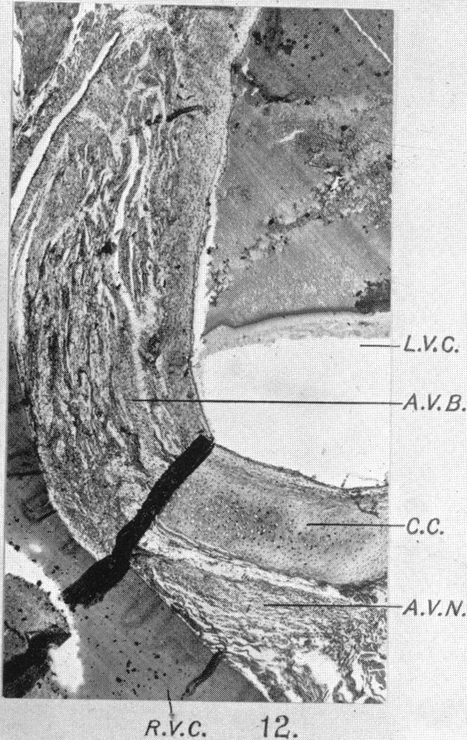 Fig. 12