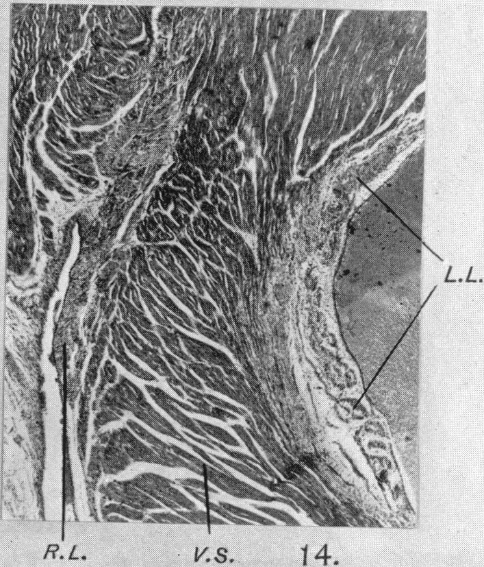 Fig. 14