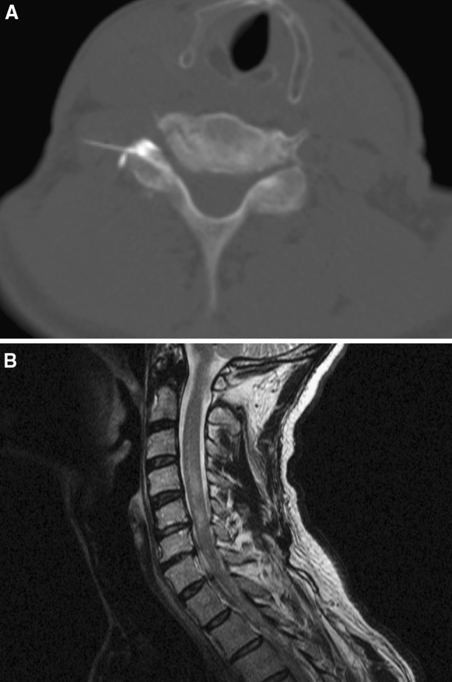 Fig. 2