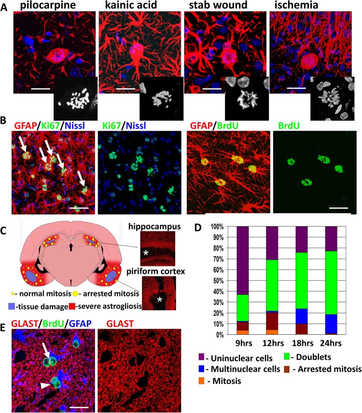 Abnormal mitosis in reactive astrocytes - PMC