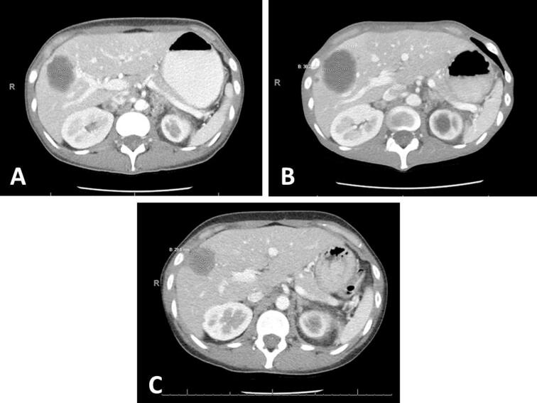 Fig. 3