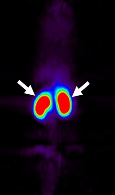 Figure 3c: