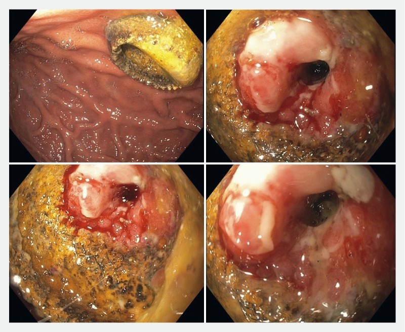 Fig. 1 