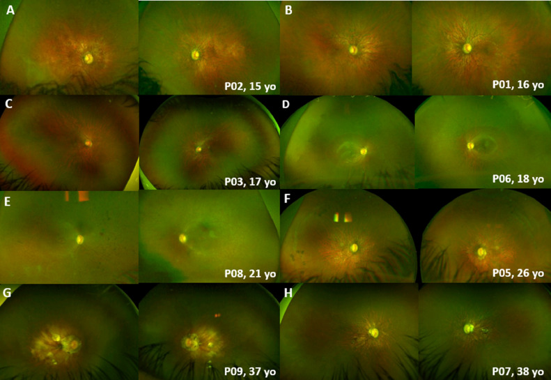 FIGURE 2