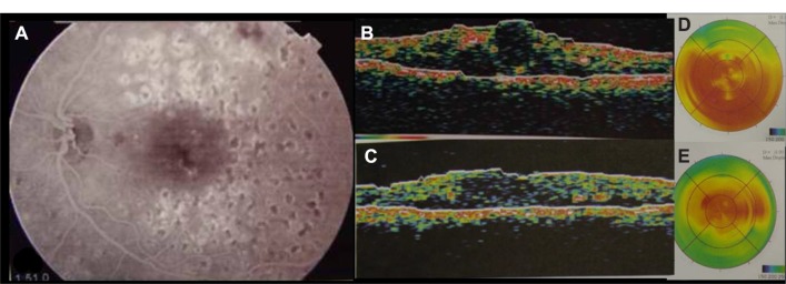 Figure 5