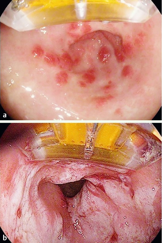 Fig. 1 a