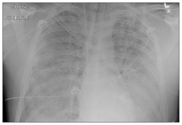 Figure 1:
