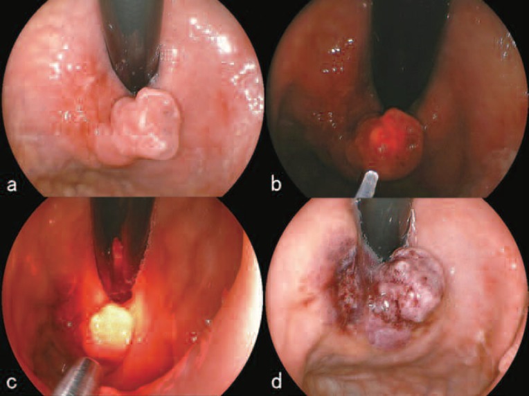 Figure 4: