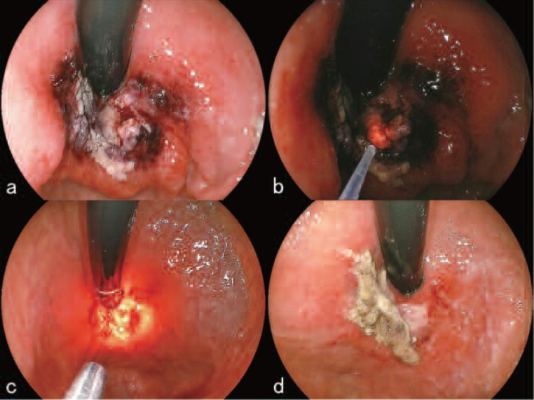 Figure 6: