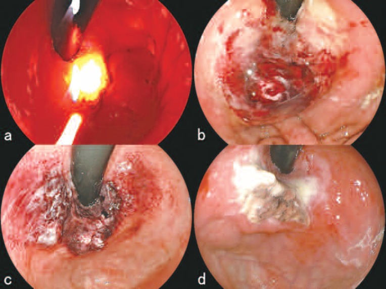 Figure 3: