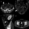 Fig. 4