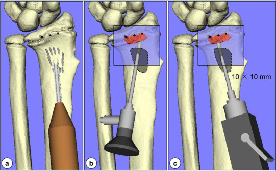 Fig. 4