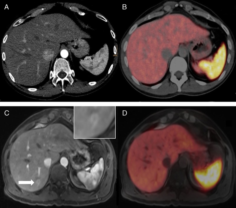 FIGURE 2