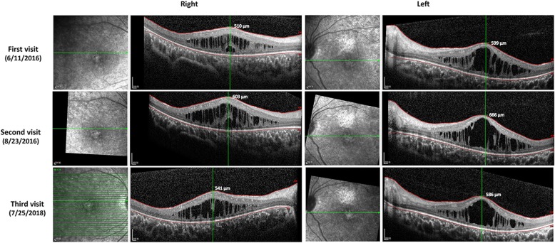 Fig. 4