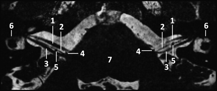 Fig 1.