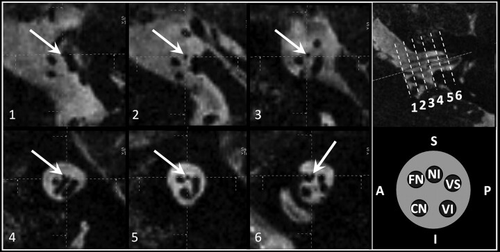 Fig 2.