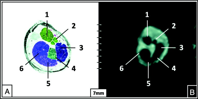 Fig 3.