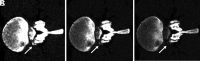 FIG 2.