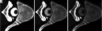 FIG 4.