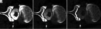 FIG 5.